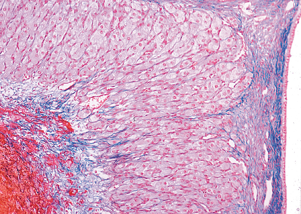 Gelbkorper Corpus Luteum Ma434d Lms Lehrmittel Service H Spath Gmbh